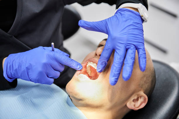 Best Emergency Wisdom Teeth Removal in Brookville, OH