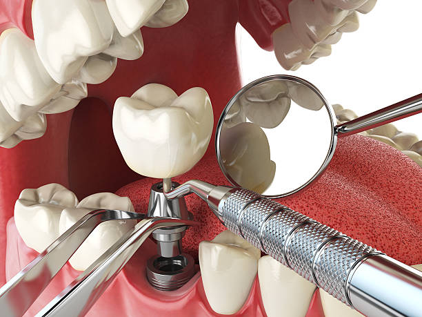 Best Weekend Emergency Dentist in Brookville, OH