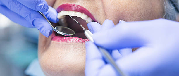 Best Urgent Care for Lost Fillings or Crowns in Brookville, OH