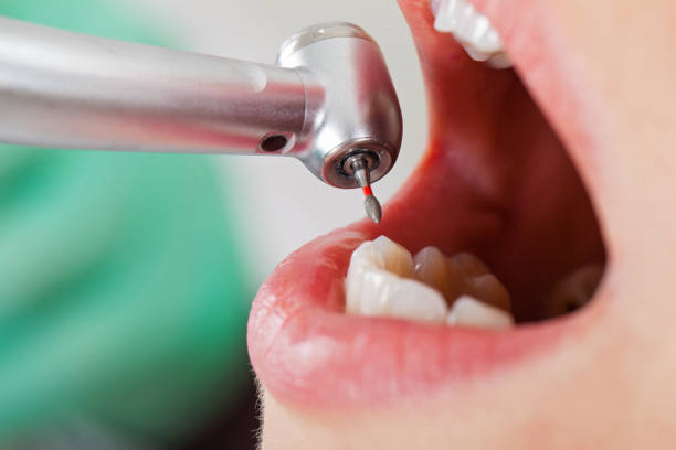 Best Emergency Gum Treatment in Brookville, OH